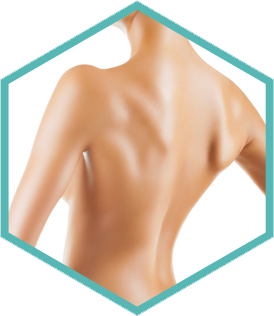 Hexagon crop of the back treatment area for Morpheus8 skin remodelling in Amsterdam